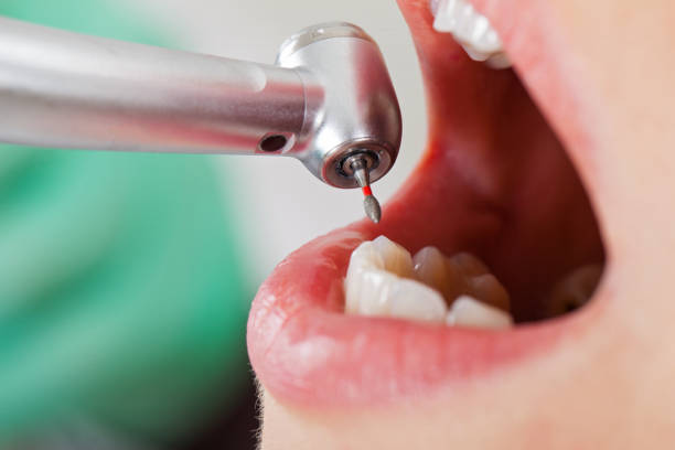 Best Broken Tooth Emergency  in Egypt, PA